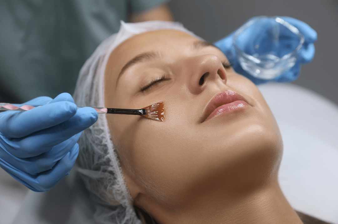 NaturaPeel Facial